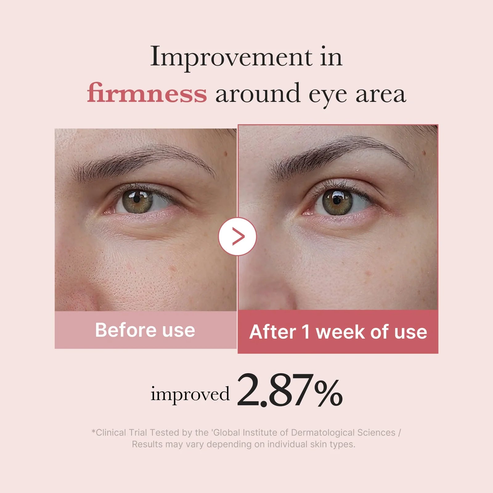 MEDICUBE - PDRN Pink Peptide Eye Cream | Crema para contorno de ojos con PDRN